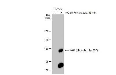 Western Blot: FAK [p Tyr397] Antibody [NBP3-12897]